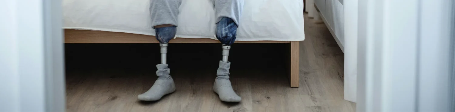 Practice Areas – Amputation